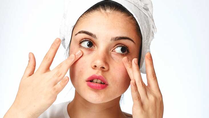 Home remedies to treat eyes dry skin